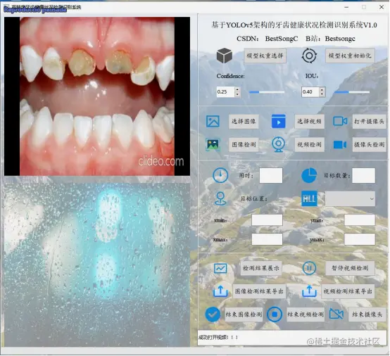 高精度牙齿健康状态检测识别系统2465.png