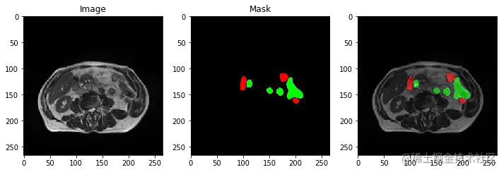 output_17_4.png