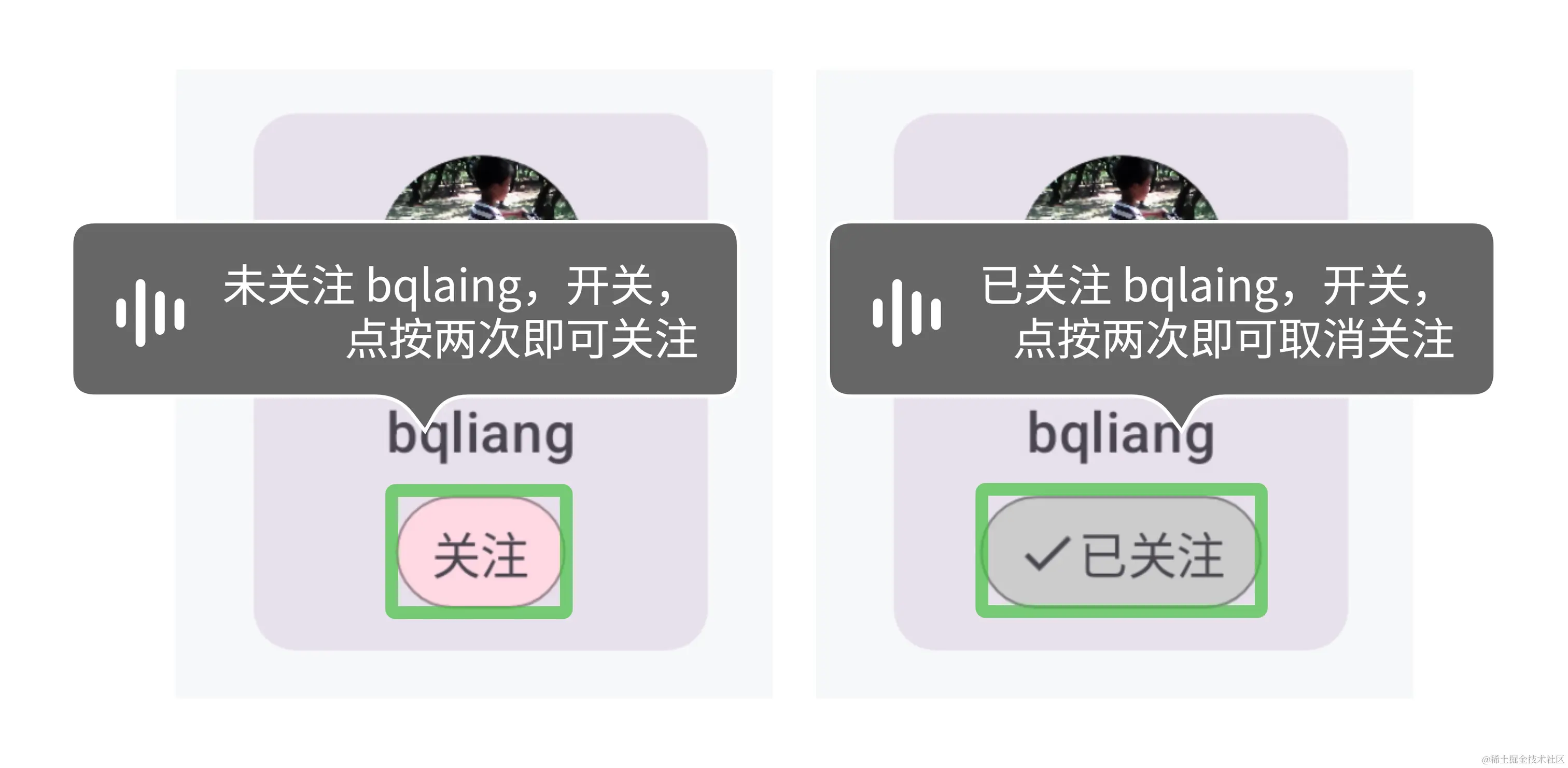 关注按钮的语义（改造后）.jpg