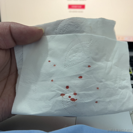 单纯_稀饭于2024-01-12 09:02发布的图片