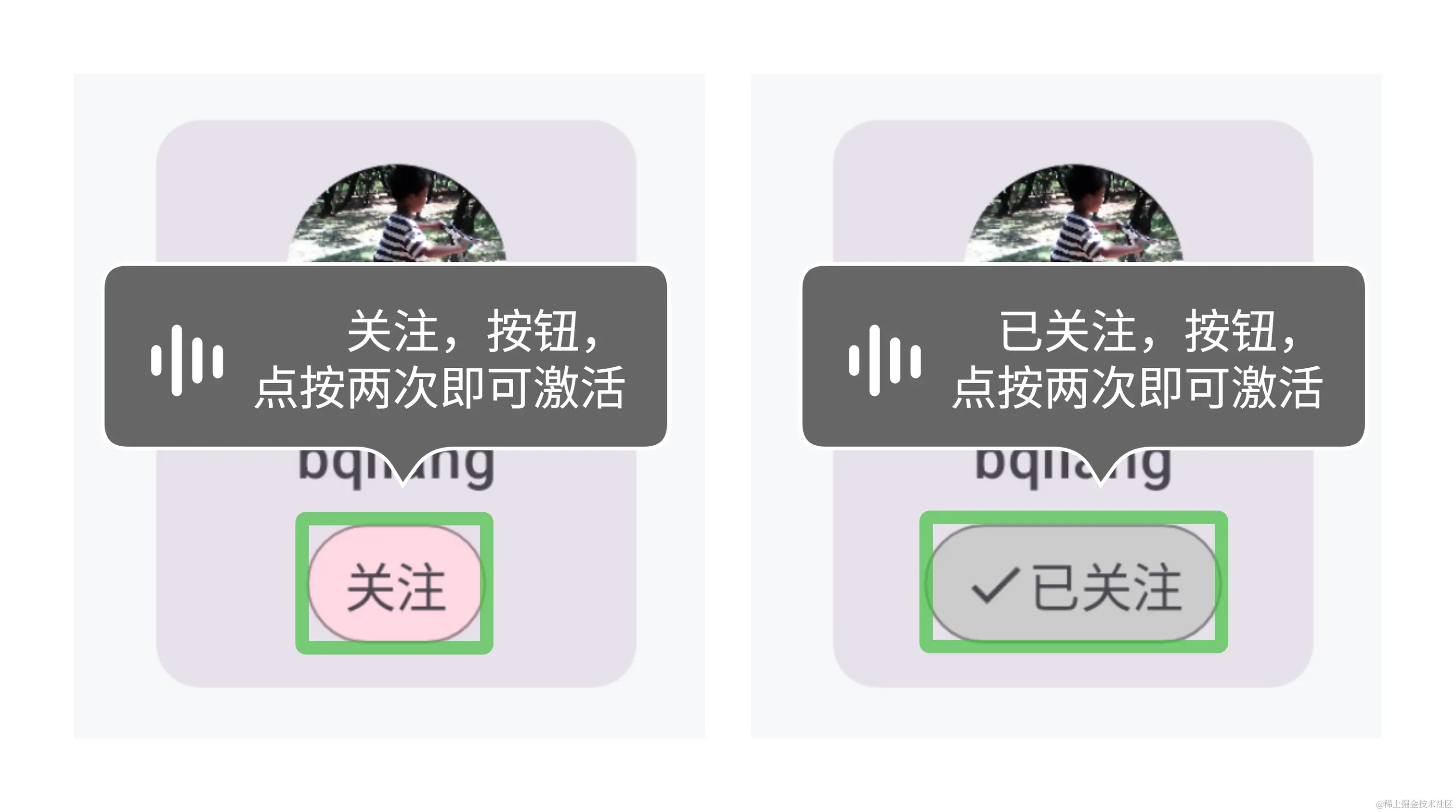 关注按钮的语义（改造前）.jpg